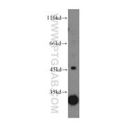 LANCL1 Rabbit Polyclonal Antibody (12647-1-AP)