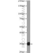 FHL5 Rabbit Polyclonal Antibody (12650-2-AP)