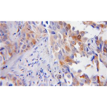 FBLN5 Rabbit Polyclonal Antibody (12188-1-AP)