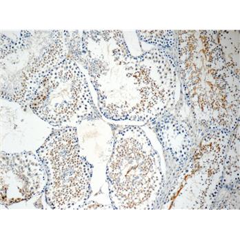 ROPN1L Rabbit Polyclonal Antibody (12565-1-AP)