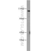 MCM10 Rabbit Polyclonal Antibody (12251-1-AP)