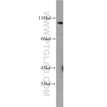 MCM10 Rabbit Polyclonal Antibody (12251-1-AP)