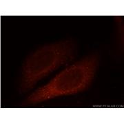 GAGE2D Rabbit Polyclonal Antibody (12532-1-AP)