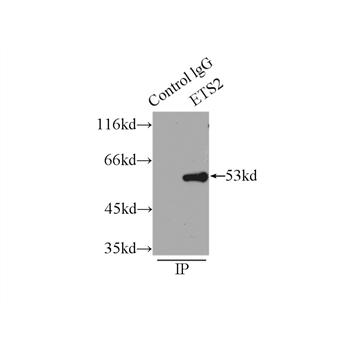 ETS2 Rabbit Polyclonal Antibody (12280-1-AP)