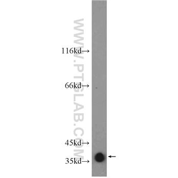 GNAO1 Rabbit Polyclonal Antibody (12635-1-AP)