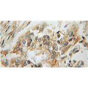 AMY2B Rabbit Polyclonal Antibody (12540-1-AP)