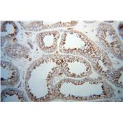 PABPC3 Rabbit Polyclonal Antibody (12625-2-AP)