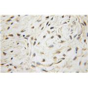 SMAD2 Rabbit Polyclonal Antibody (12570-1-AP)