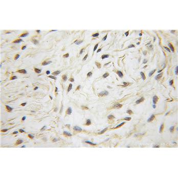 SMAD2 Rabbit Polyclonal Antibody (12570-1-AP)