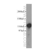 SKIV2L2 Rabbit Polyclonal Antibody (12719-2-AP)