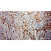 CHFR Rabbit Polyclonal Antibody (12169-1-AP)