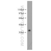 RFFL Rabbit Polyclonal Antibody (12687-1-AP)