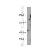ASH2L Rabbit Polyclonal Antibody (12331-1-AP)