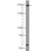 MYO9B Rabbit Polyclonal Antibody (12432-1-AP)