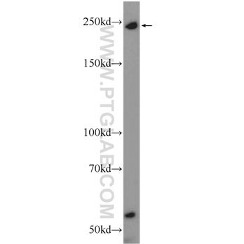 MYO9B Rabbit Polyclonal Antibody (12432-1-AP)