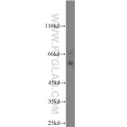 PTGS2 Rabbit Polyclonal Antibody (12375-1-AP)