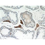 UNG Rabbit Polyclonal Antibody (12394-1-AP)