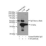 CA8 Rabbit Polyclonal Antibody (12391-1-AP)