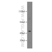 CTBS Rabbit Polyclonal Antibody (12599-1-AP)
