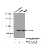 LCP2 Rabbit Polyclonal Antibody (12728-1-AP)