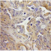 TSP50 Rabbit Polyclonal Antibody (12574-1-AP)