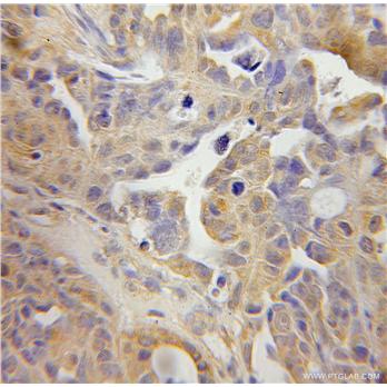 TSP50 Rabbit Polyclonal Antibody (12574-1-AP)