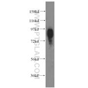 SLC20A1 Rabbit Polyclonal Antibody (12423-1-AP)