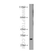 TSPAN6 Rabbit Polyclonal Antibody (12293-1-AP)