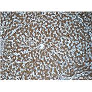 SERPINA3 Rabbit Polyclonal Antibody (12192-1-AP)