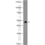 ZFP36L1 Rabbit Polyclonal Antibody (12306-1-AP)