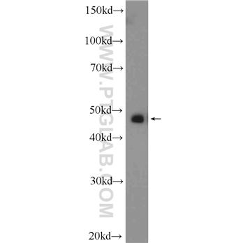 ZFP36L1 Rabbit Polyclonal Antibody (12306-1-AP)