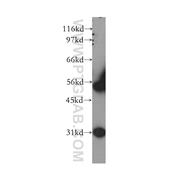WT1 Rabbit Polyclonal Antibody (12609-1-AP)