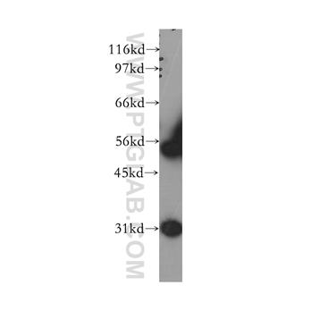 WT1 Rabbit Polyclonal Antibody (12609-1-AP)