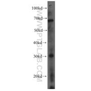 MARCH5 Rabbit Polyclonal Antibody (12213-1-AP)