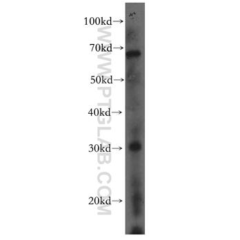MARCH5 Rabbit Polyclonal Antibody (12213-1-AP)