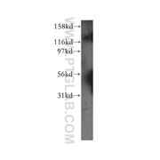 USP25 Rabbit Polyclonal Antibody (12199-1-AP)