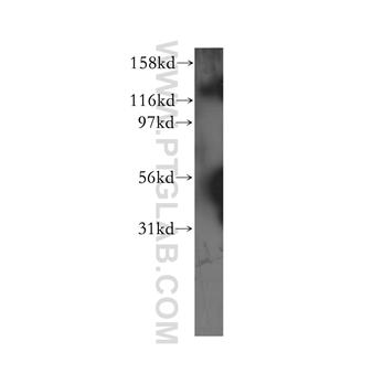 USP25 Rabbit Polyclonal Antibody (12199-1-AP)