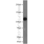 PTK2 Rabbit Polyclonal Antibody (12636-1-AP)