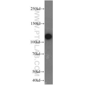 PTK2 Rabbit Polyclonal Antibody (12636-1-AP)