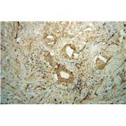 GNAI1 Rabbit Polyclonal Antibody (12617-1-AP)