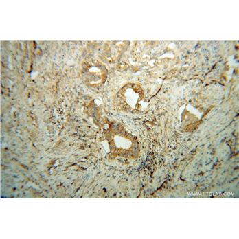GNAI1 Rabbit Polyclonal Antibody (12617-1-AP)