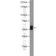 PRKAG2 Rabbit Polyclonal Antibody (12568-1-AP)