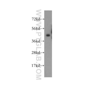 MVK Rabbit Polyclonal Antibody (12228-1-AP)