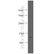 SF3B14 Rabbit Polyclonal Antibody (12379-1-AP)