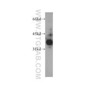 ELMOD1 Rabbit Polyclonal Antibody (12761-1-AP)