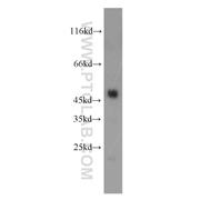 CPB1 Rabbit Polyclonal Antibody (12600-1-AP)
