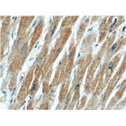 MFN2 Rabbit Polyclonal Antibody (12186-1-AP)