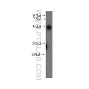 UBAP1 Rabbit Polyclonal Antibody (12385-1-AP)