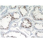 CLGN Rabbit Polyclonal Antibody (12629-1-AP)