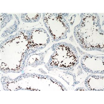 CLGN Rabbit Polyclonal Antibody (12629-1-AP)